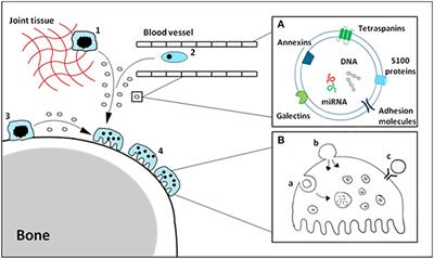 Macrophage-Derived Extracellular Vesicles as Carriers of Alarmins and Their Potential Involvement in Bone Homeostasis